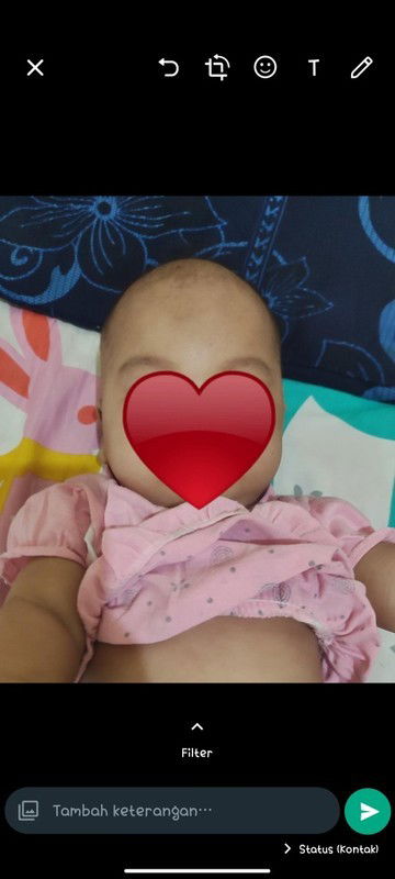 Kepala bayi umur 5 bulan