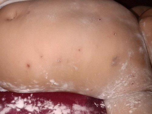 Bayi lima bulan