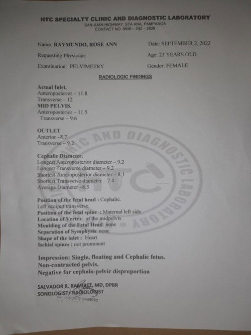 Ano po ibig sabihin ng negative for cephalo-pelvic disproportion?