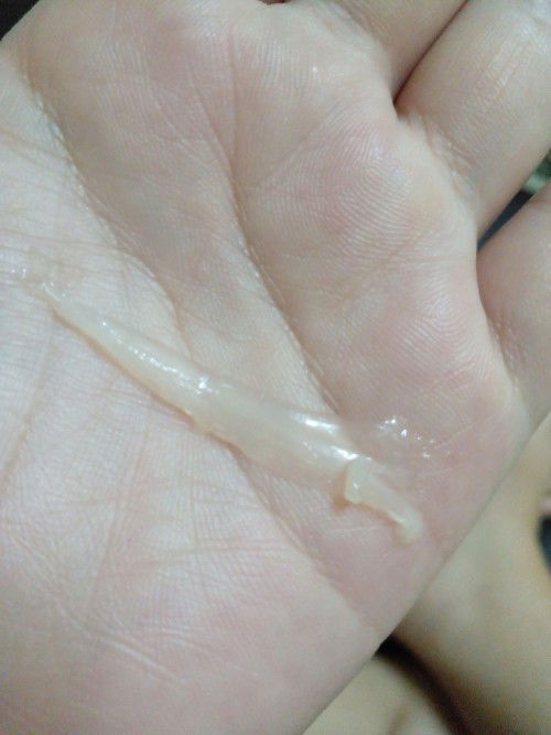 ไปหาหมอเลยไหมค่ะ ไม่มีอาการ  มีใส่ออกมาแบบนี้