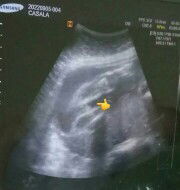 Ano po sa tingin nyo?