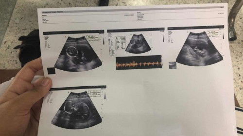 รูปไหนที่บอกเพศบ้างค่ะแม่ๆคนไหนพอดูออกไหมค่ะ