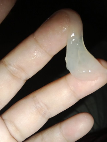 Bunda mau tanya perut seeing kencang dan kaya bayi nekan ke bawah jalan lahiran tu konpal, wajar gak
