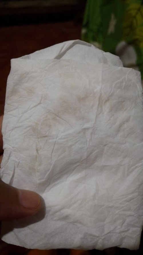 Usia kehamilan 6 Minggu 6 hari terdapat flek