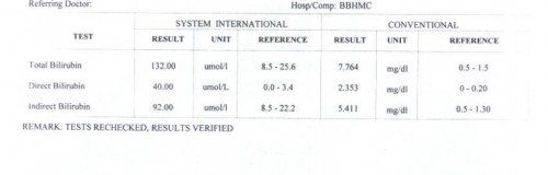 Bilirubin result