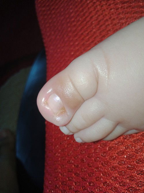 Cantengan apa mata ikan?