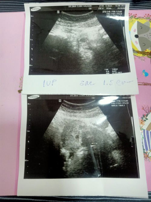 ความรู้สึกคือหยุดร้องไห้ไม่ได้เลยค่ะ