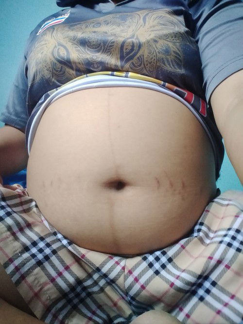 ท้องแบบนี้จะได้ ลูกสาว ลูกชายค่ะ