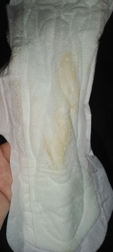 มูกเลือดใช่มั้ย????