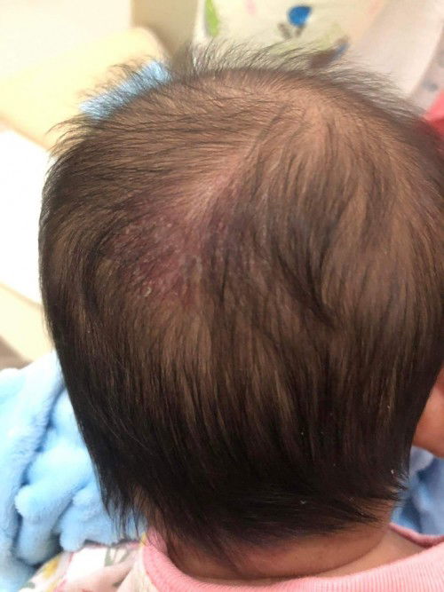หัวน้องเป็นแบบนี้ เกิดจากอะไร แก้ยังไงดีครับ ??
