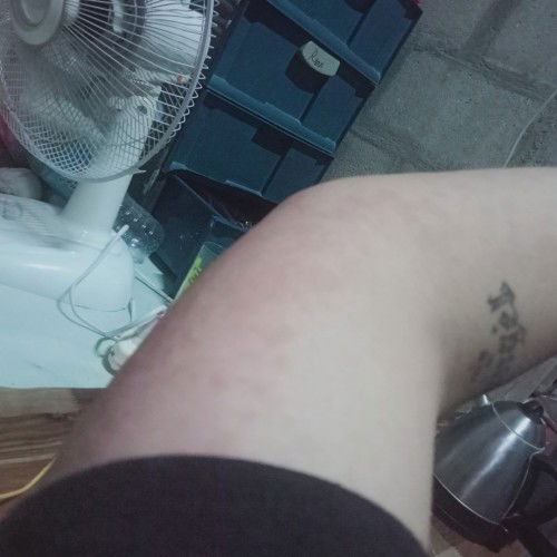 Rashes/Katikati after giving birth.