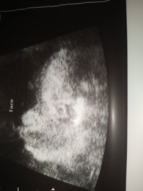 CAS RESULTS...
GENDER...