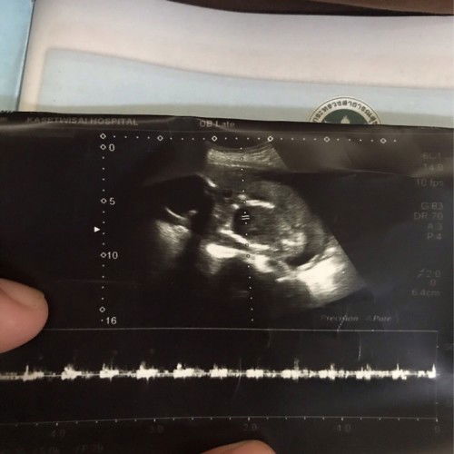 อยากทราบเพศลูก