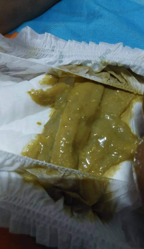 normal poop po ba ang ganyan ?