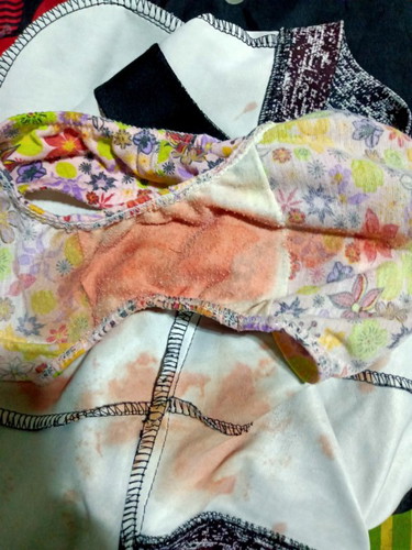 31 weeks na po ako, bakit po kaya May dugo na parang nireregla tas ngayong umaga spotting na lang sy