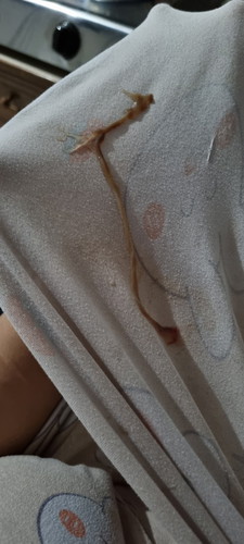 Is this mucus plug? Should i go hospital?