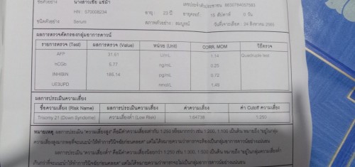 ผลตรวจดาวน์ซินโดรม