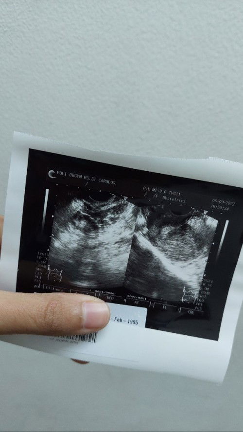 Gagal untuk ke 2x nya