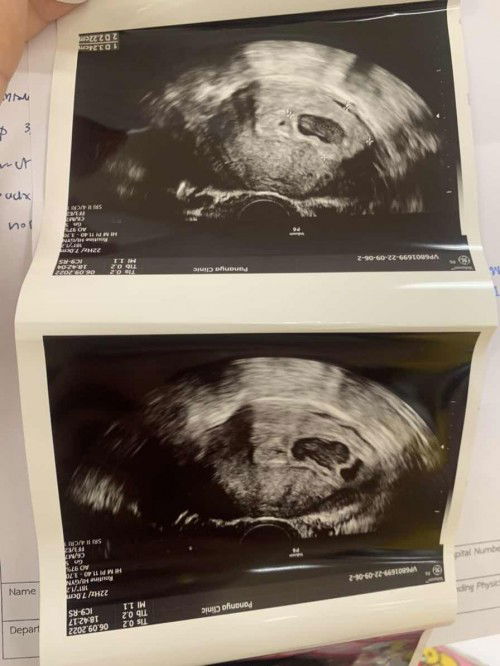 แท้ง2ท้องแล้ว😓😓😓