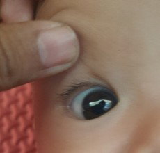 Mata bayi 4 bulan