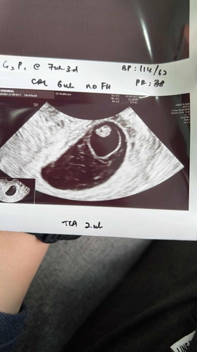 Tiada heartbeat