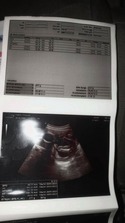 เเบบนี้มีโอกาสคลาดเคลื่อนมั้ยคะ