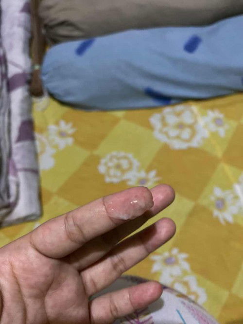 Ini flek atau keputihan biasa