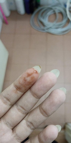 มีคล้ายเลือดสีน้ำตาลออกมาค่ะ