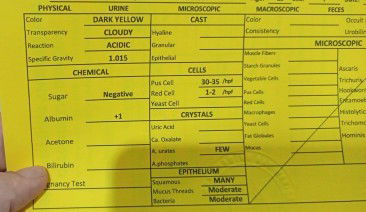 KINAKABAHAN AKO BIGLA