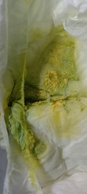 Warna feses bayi usia 18 hari