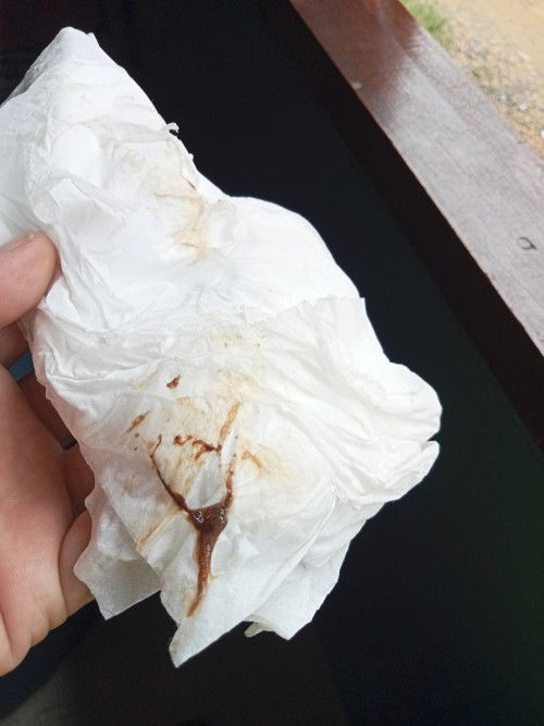 สอบถามน่อยค่ะแม่ๆ