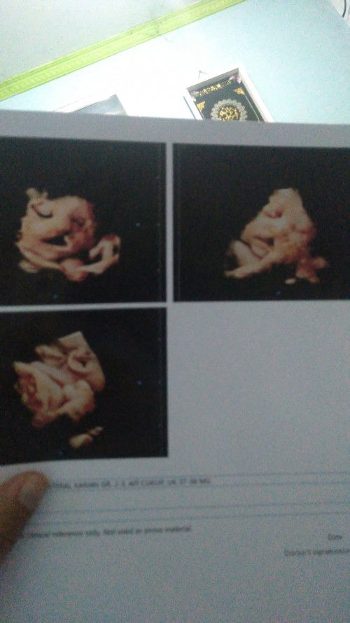 Mau nanya pendapat bunda bunda dong 🙏