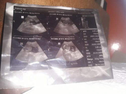 jenis kelamin 19 minggu