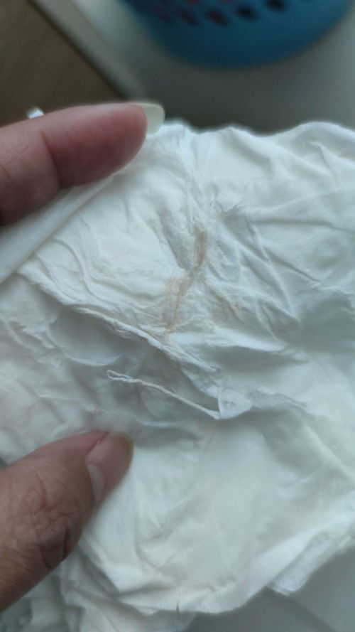 Flek bahaya ato tdk?