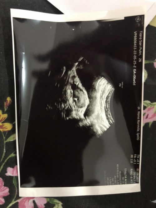 hamil 2 bulan (8 minggu)