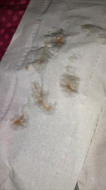 Usia Kandungan 37 Minggu 3 hari