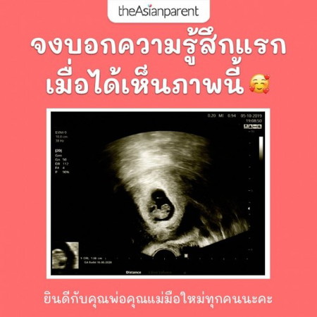 ความรู้สึกของคนเป็นแม่ ❤