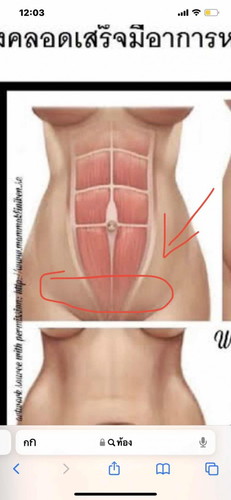 สอบถามหน้อยค่ะ อีนตรายมากน้อยแค่ไหน