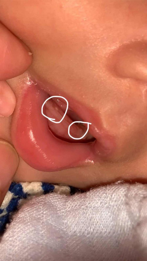 น้องอายุ1เดือน3วัน