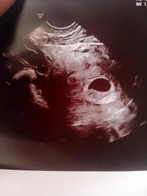 เครียดมากเลยค่ะแม่ๆ