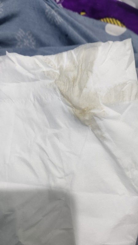 Hamil 6w 3d keputihan