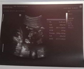 ผู้ชาย หรือ ผู้หญิงคะ