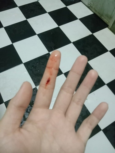 มีเลือดออกทางช่องคลอด