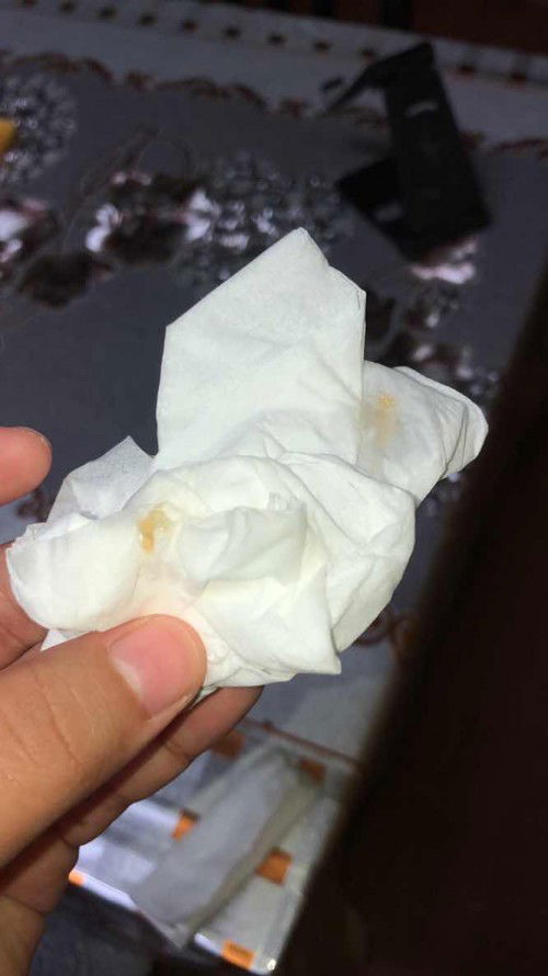 ingin tahuu ini lendir apa 👩‍⚕️