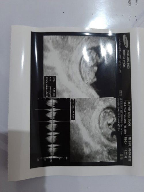 Ganti dokter & Tenpat USG