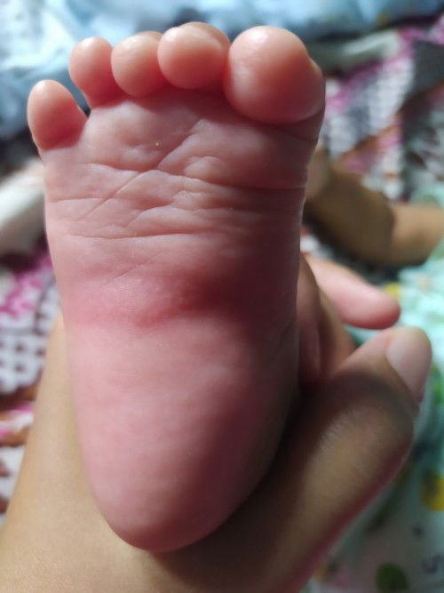 Bintik bintik berair