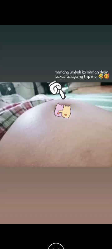 Umbok ni Baby sa One Side.