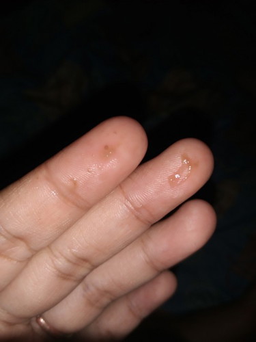 38minggu 1hari , ada lendir