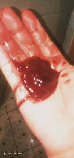 After 4 months manganak- Blood