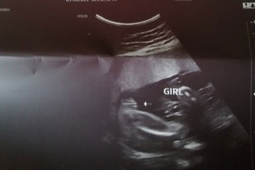 Gender. SURE NA PO BA ITO